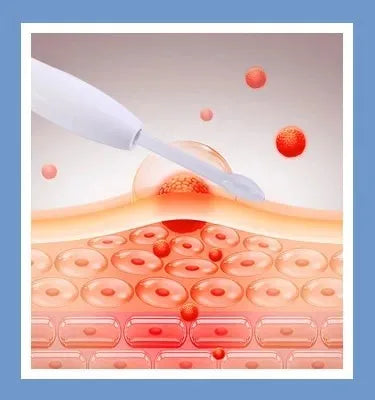 Hydra Beauty 14‑in‑1 Professional HydraFacial Machine