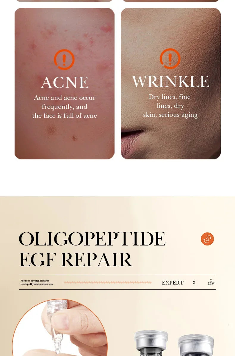 BIOAQUA Yeast Peptide Microneedling Serum Set – 12 Ampoules