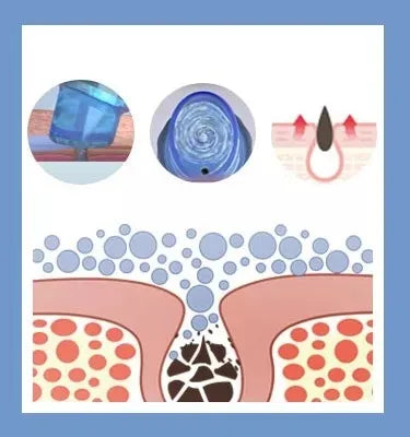 Hydra Beauty 14‑in‑1 Professional HydraFacial Machine